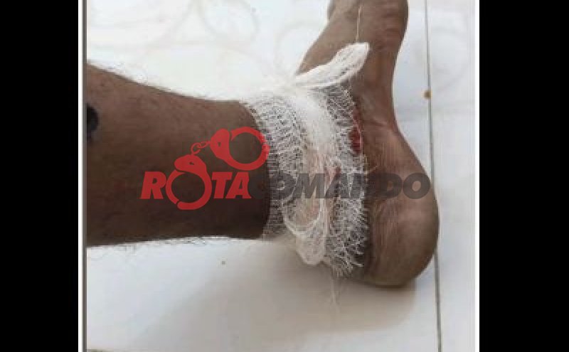Acidente de trânsito na zona rural de São Miguel deixa jovem gravemente ferido