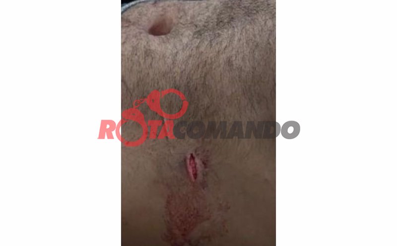 Homem é esfaqueado e tem motocicleta roubada em Costa Marques