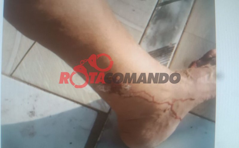 Duas pessoas ficam feridas após serem atacadas por cães em Alvorada do Oeste